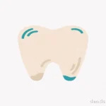 Tooth Extraction: What to Know Tooth extraction — featured image