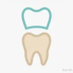 Dental crowns explained — featured image